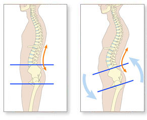 back pain diagram